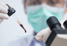 Santé: R21 Matrix-M, un nouveau vaccin antipaludique suscite beaucoup d’espoirs